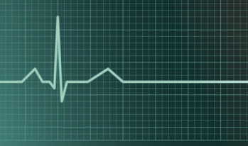 Monitor flatline Monitor flatline
